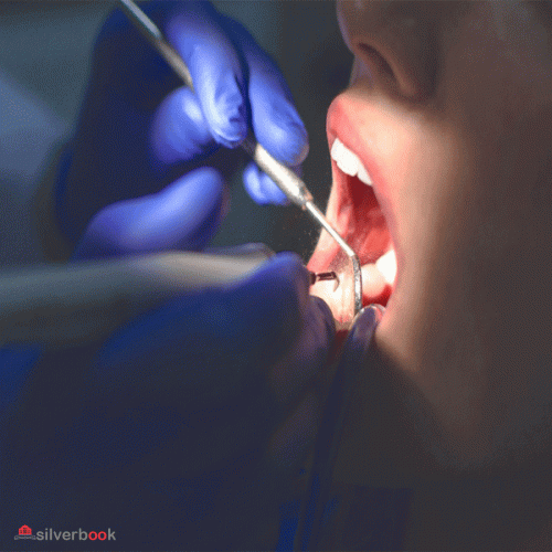 متخصص درمان ریشه دندان در آزادی