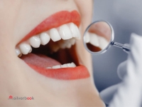 کامپوزیت دندان درمانی ایمپلنت دندانپزشکی